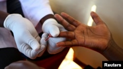 2014年5月16日烏干達醫生為民眾驗血測試愛滋病毒。(資料照)