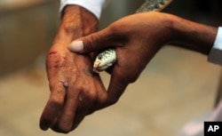 FILE - A snake charmer points out a snakebite during a performance with a snake outside a temple in Allahabad, India, Aug. 19, 2013.