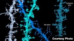 3D images of synapses that shrink during sleep. Credit: Wisconsin Center for Sleep and Consciousness