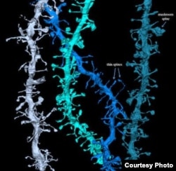 3D images of synapses that shrink during sleep. Credit: Wisconsin Center for Sleep and Consciousness