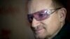 Bono Khawatir Tak Bisa Lagi Main Gitar