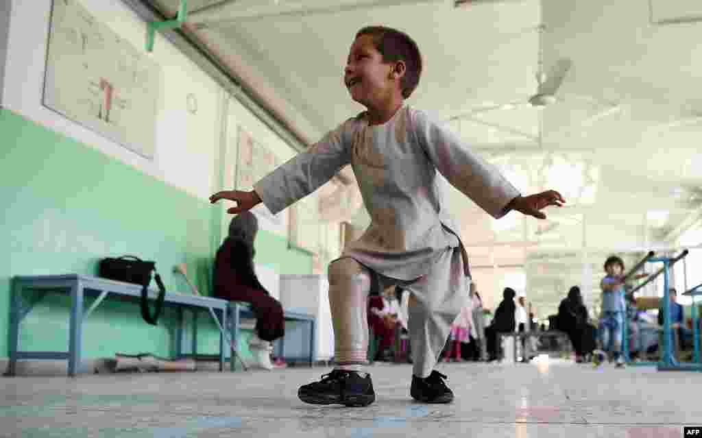 Ahmad Sayed Rahman, a five-year-old Afghan boy who lost his right leg when he was hit by a bullet in the crossfire of a battle, dances with his prosthetic leg at the International Committee of the Red Cross (ICRC) hospital for war victims and the disabled, in Kabul, Afghanistan.