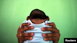 FILE - A mother holds her son who is 4-months old and born with microcephaly, in Olinda, near Recife, Brazil, Feb. 11, 2016. Researcher Carlos Pardo says that during the height of the Zika outbreak the magnitude of the paralytic disease Guillain-Barre was similar to that of microcephaly but went underreported.
