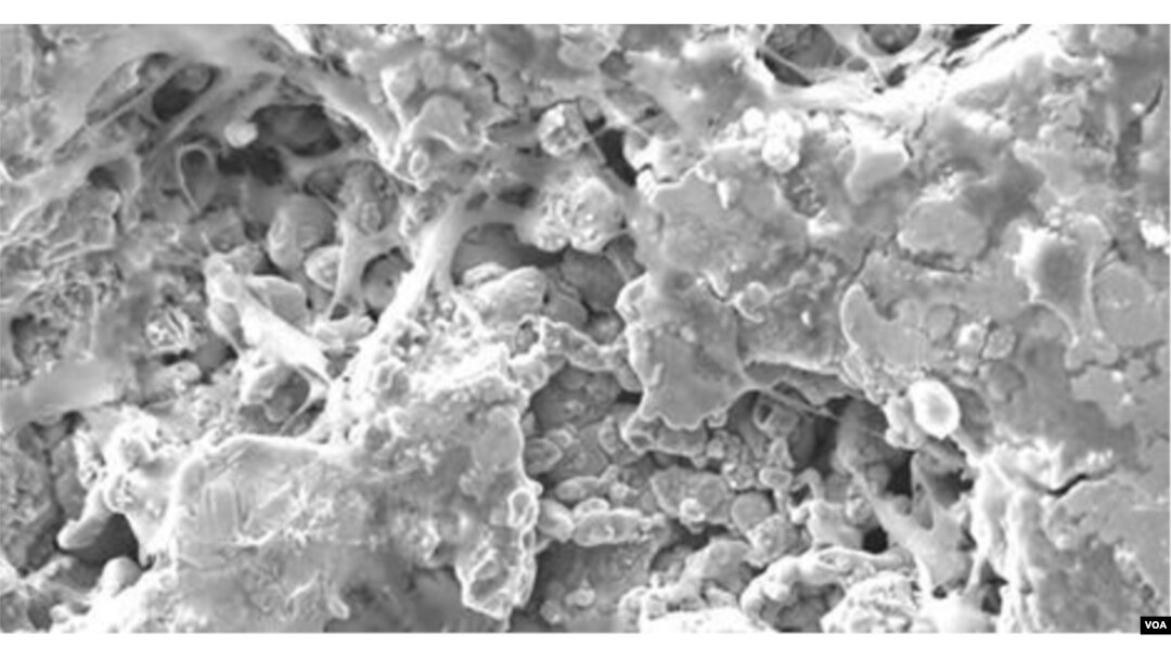 Bone cells attach to 3-D-printed scaffolding. When bone completely heals the material will degrade. (University of Pittsburgh)
