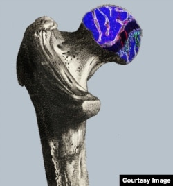 Schematic of the head of a femur (the thigh bone), showing OCR stem cells in red and the growth of bone (green), cartilage and stromal cells. (Mike Barnett for Columbia University Medical Center)