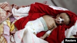 A malnourished boy lies on a bed in the malnutrition ward of al-Sabeen hospital in Sana'a, Yemen, Sept. 10, 2018.