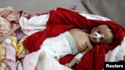 A boy lies on a bed in the malnutrition ward of al-Sabeen hospital in Sana'a, Yemen, Sept. 10, 2018.