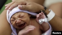 Phụ nữ mang thai bị nhiễm virus Zika có nguy cơ sinh ra những em bé bị tật đầu nhỏ.