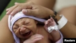 Zika diduga terkait dengan microcephaly, sebuah gangguan saraf di mana bayi dilahirkan dengan kepala kecil (foto: ilustrasi).