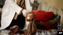 FILE - A malnourished child receives heath care at a feeding center run by Doctors Without Borders in Maiduguri, Nigeria, Aug. 29, 2016. 