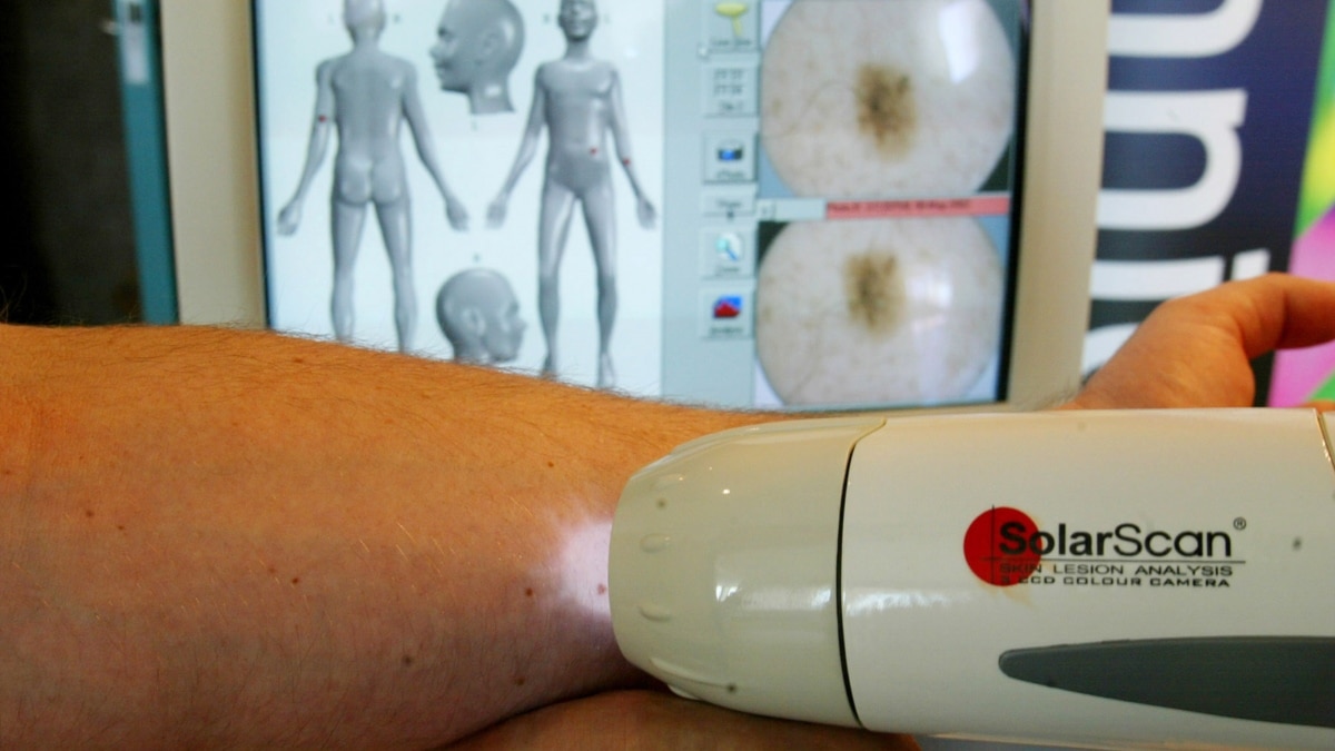 Famous Australian Skin Cancer Ad Returns to the Airwaves - Vimarsana News