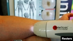 SolaScan, a new device to detect skin cancer, is demonstrated at its launch in Sydney, Australia, May 7, 2002.