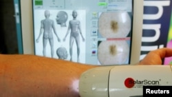 FILE - SolaScan, a new device to detect skin cancer, is demonstrated at its launch in Sydney, Australia, May 7, 2002. Scientists in Australia say in July 2018, they have developed the world's first blood test to detect melanoma in its early stages.