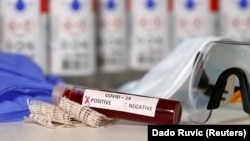 Testiranje krvi na koronavirus (ilustracija)