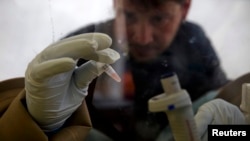 FILE - A scientist separates blood cells from plasma cells to isolate any Ebola RNA in order to test for the virus at the European Mobile Laboratory in Gueckedou, Guinea.