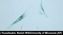 This April 2019 microscope photo provided by the Niedernhofer Lab of the Institute on the Biology of Aging and Metabolism at the University of Minnesota shows shows two senescent human fibroblast cells, above, next to normal ones in Minneapolis, Minnesota