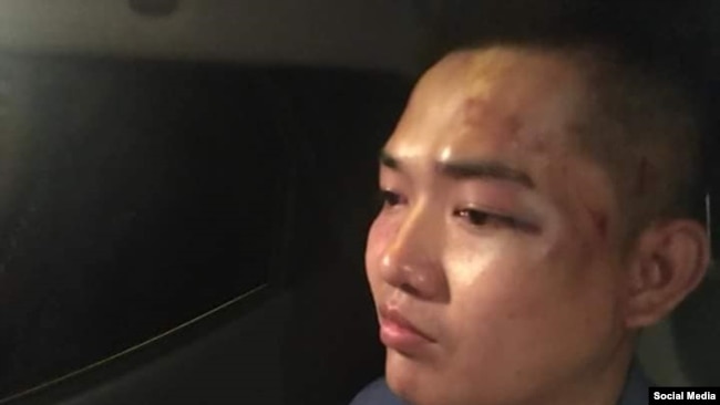 Ca sĩ Nguyễn Tín sau khi bị đánh đêm 15/8/2018. Facebook Dương Đại Triều Lâm.