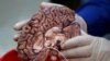 Study: Breaking Blood-Brain Barrier to Treat Brain Diseases