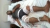 No Aid Drove Yemeni Man to Self-immolation, Friends Say