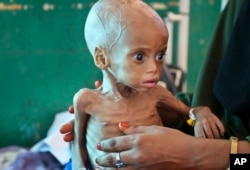 Acutely malnourished child, Sacdiyo Mohamed, 9 months old, is treated at the Banadir Hospital after her mother fled the drought in southern Somalia and traveled by car to the capital Mogadishu, March 11, 2017. Projects to help prevent drought and flood related disasters are sharing a $10 million grant.