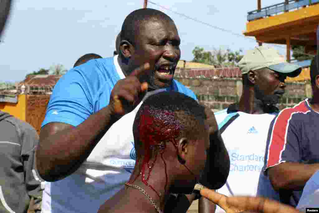 A woman bleeds from the head after being struck by a police officer after residents placed roadblocks on the street to demand faster removal of dead bodies infected with Ebola virus in the Aberdeen district of Freetown, Sierra Leone, Oct. 14, 2014.