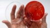 Bakteri Kebal Menyebar, WHO Ingatkan Ketiadaan Antibiotik Baru
