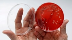 Quiz - US Superbug Infections Rising, Deaths Falling