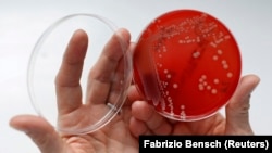 An employee at a microbiological laboratory in Berlin displays MRSA, a drug-resistant "superbug" that can cause deadly infections.
