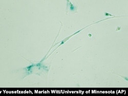 This April 2019 microscope photo provided by the Niedernhofer Lab of the Institute on the Biology of Aging and Metabolism at the University of Minnesota shows senescent human fibroblast cells in Minneapolis, Minn.