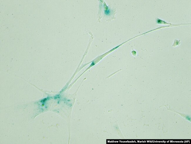 This April 2019 microscope photo provided by the Niedernhofer Lab of the Institute on the Biology of Aging and Metabolism at the University of Minnesota shows senescent human fibroblast cells in Minneapolis, Minn.