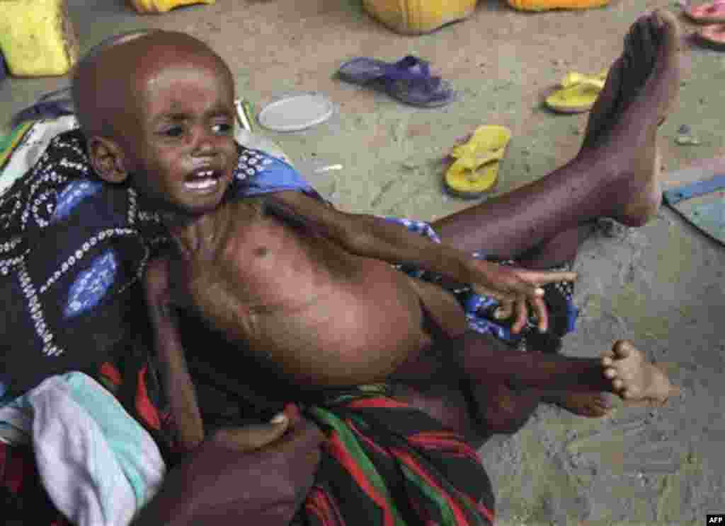 A malnourished child from southern Somalia cries on his mother's lap, at a refugee camp in Mogadishu, Somala, The United Nations says famine will probably spread to all of southern Somalia within a month and force tens of thousands more people to flee in