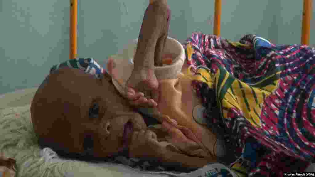 Cet enfant de 5 mois souffre de malnutrition aiguë au centre régional de santé mère enfant de Diffa, Niger, le 18 avril 2017 (VOA/Nicolas Pinault)