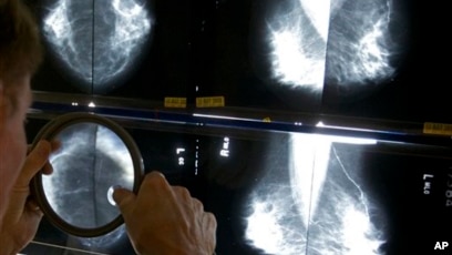 Breast Cancer Signs, Symptoms and Understanding an Imaging Report