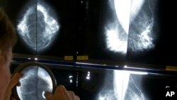 FILE - Radiologist uses magnifying glass to check mammograms for breast cancer in Los Angeles.