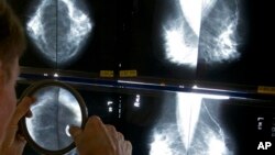 Radiolog proverava mamogram koristeći lupu
