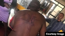 Blessing Kanotunga was abducted and seriously assaulted by state security agents.