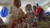Urgent Treatment Needed For Malnourished Children In Sahel