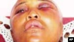 米丽桑特·加伊卡在南非开普敦某镇遭到“教训式”强奸。（资料照）