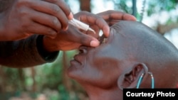 A doctor examines a trachoma patient in Ethiopia, Nov. 3, 2014.