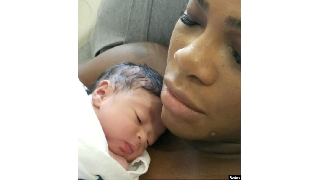 Tennis player Serena Williams poses with her daughter Alexis Olympia Ohanian Jr. in an undisclosed location, Sept. 13, 2017 in this picture obtained from a social media.