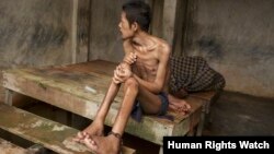 Before he died, this man lived chained to a platform at Kyai Syamsul's center in Brebes, Central Java. While there his ankles swelled, his body became emaciated. © 2012 Andrea Star Reese for Human Rights Watch