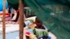 A malnourished girl plays at a hospital in a U.N. refugee camp in Malakal, July 24, 2014.