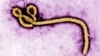 Vírus Ébola visto ao microscópio