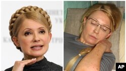 On the left then Ukrainian Prime Minister Yulia Tymoshenko in a Dec. 29, 2009 file photo, on the right, Tymoshenko, in a photo provided by Ukrainian Pravda taken April 25, 2012, shows bruises on her body to the Ukrainian Commissioner for Human Rights in K