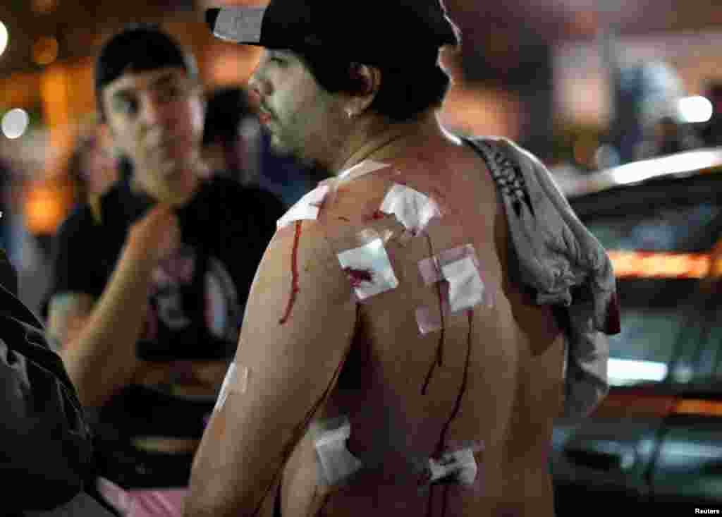 Un hombre espera en un hospital de emergencia, luego de ser herido por perdigones en las protestas del martes 12 de noviembre de 2019 en Chile.
