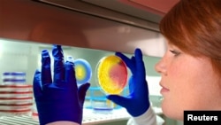 CDC microbiologist, Valerie Albrecht, holds up two plates of methicillin-resistant Staphylococcus aureus (MRSA) in this undated CDC handout photo. 