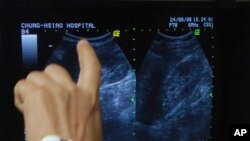 Ilustrasi - Seorang dokter memeriksa tes batu ginjal ultrasonik Eric Wu di rumah sakit Taipei Zhongjiao, Rabu, 24 September 2008, di Taipei, Taiwan.(AP/Chiang Ying-ying)