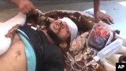 Citizen journalism image made from video provided by Shaam News Network SNN, purports to show a victim wounded by violence that, according to anti-regime activists, was carried out by government forces in Tremseh, Syria, July 12, 2012.