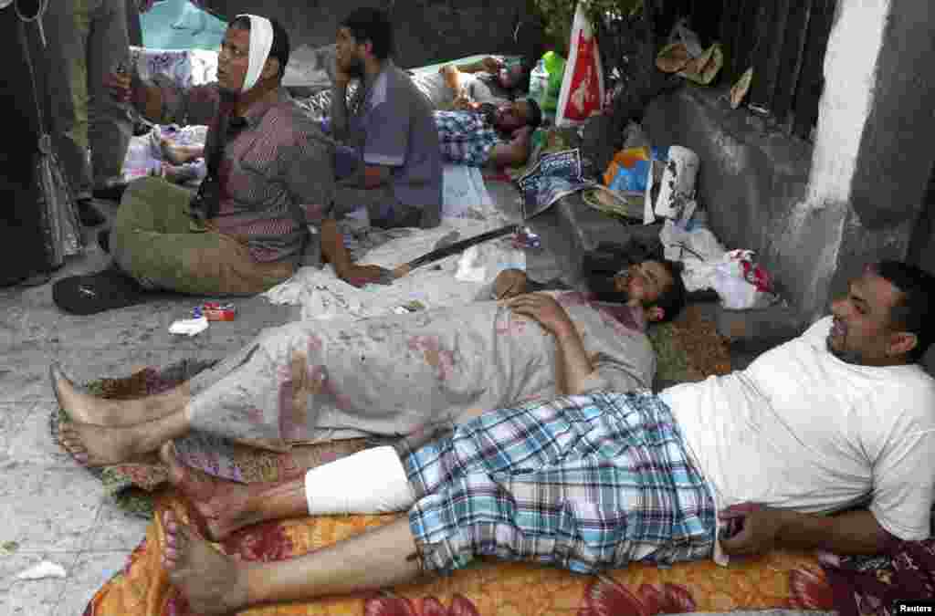 Wounded supporters of deposed Egyptian President Mohamed Morsi wait for treatment at a field hospital in Cairo, July 8, 2013.&nbsp;