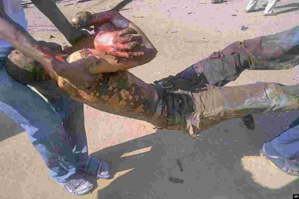 Rescuers carry a victim of a bomb explosion in Nigeria's northern city of Kaduna December 7, 2011. A powerful explosion struck the northern Nigerian city of Kaduna on Wednesday, killing at least six people, eyewitnesses said. It was not clear what caused 